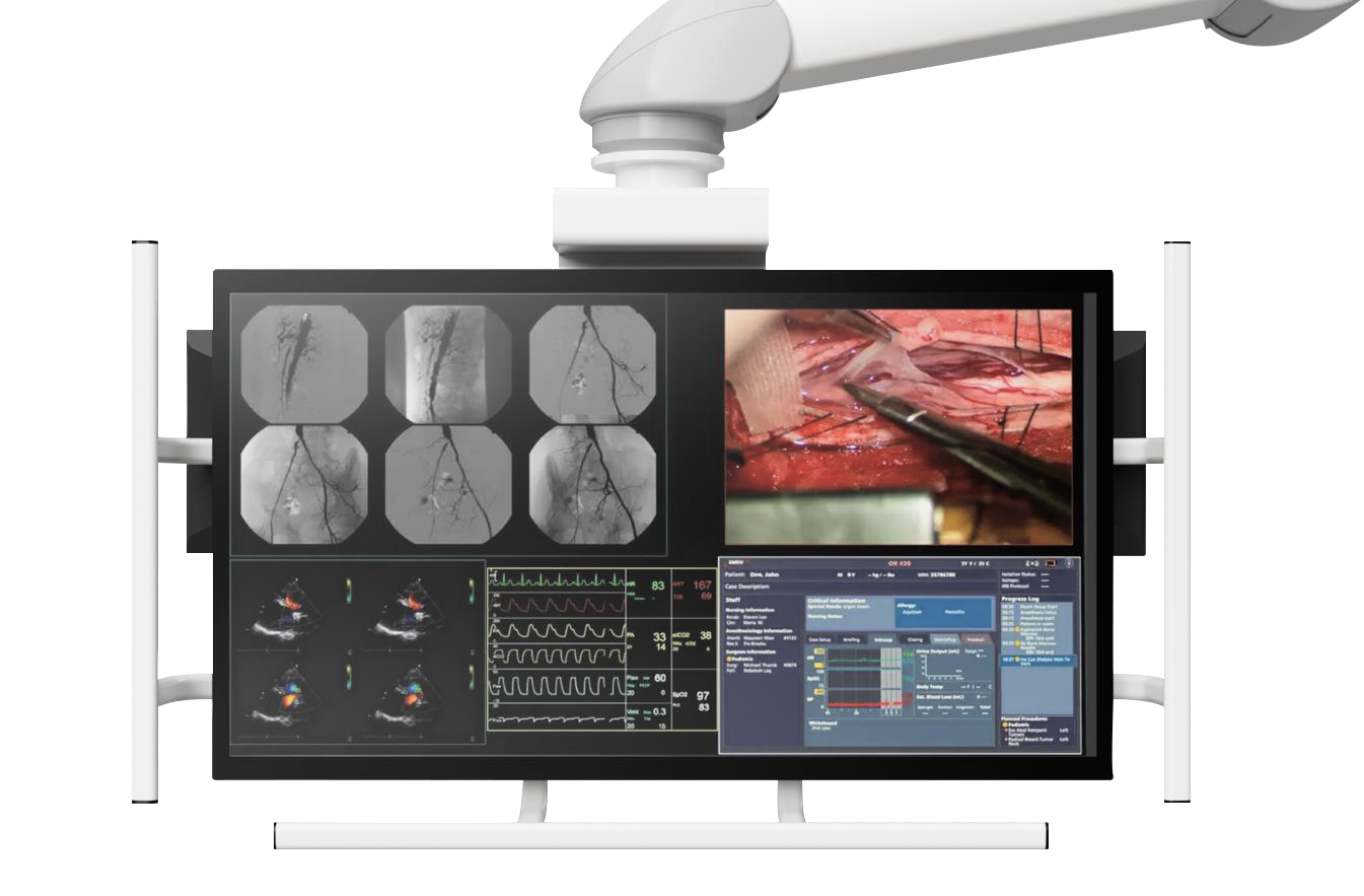 large-monitor-mount-2